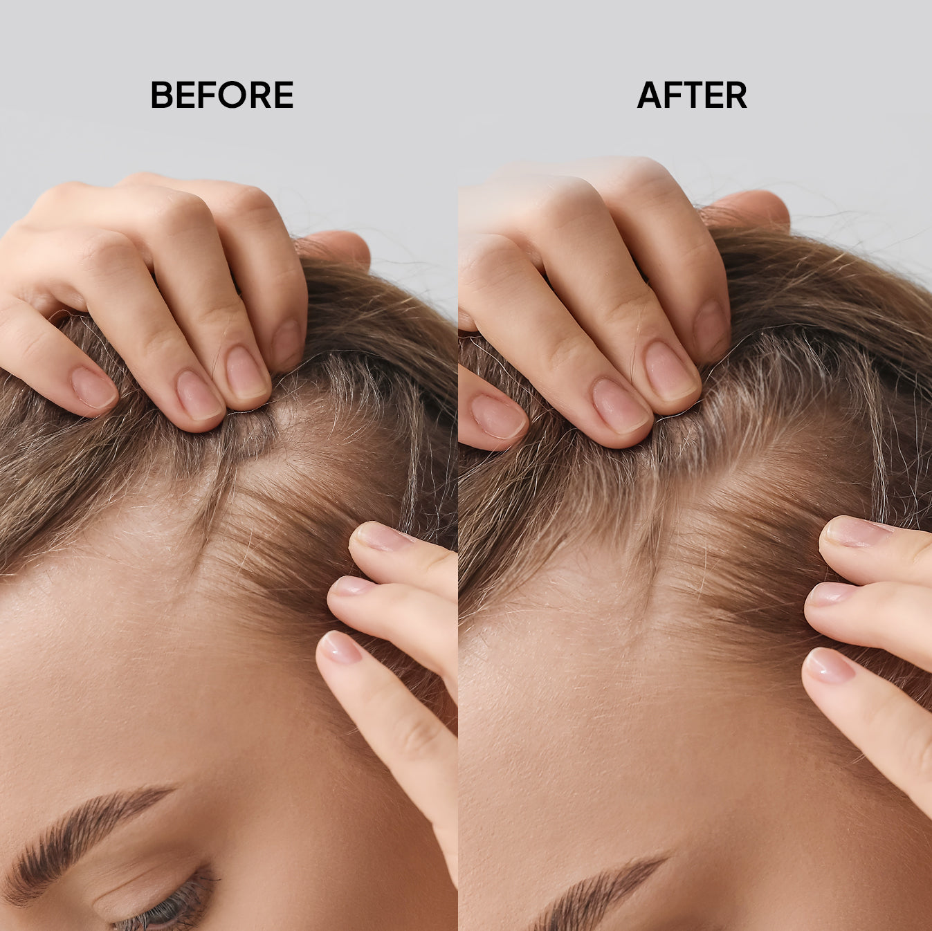 Hair Thickening scalp Refresher Spray (3.3oz)