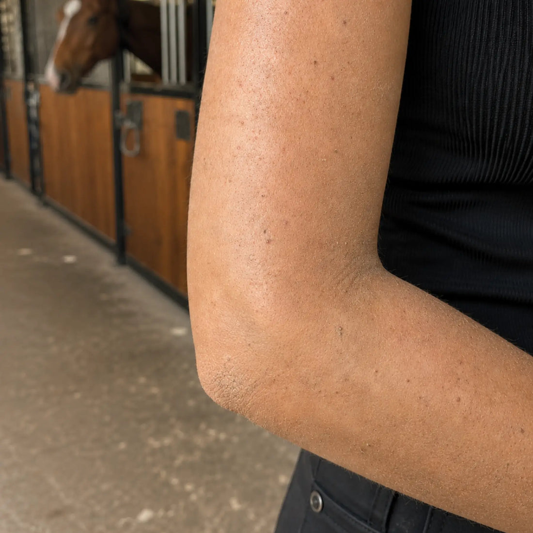 An equestrian's arm having barn dust and mild blemishes before using CoBa's Daughter Coffee Exfoliator