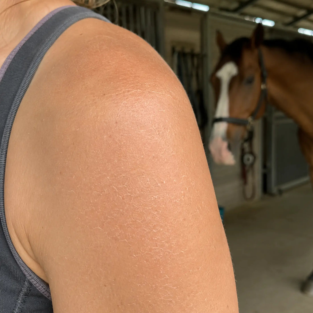 An equestrian's dry and dehydrated skin before using CoBa's Daughter Coffee Exfoliator