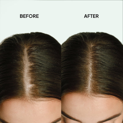 Hair Thickening scalp Refresher Spray (3.3oz)