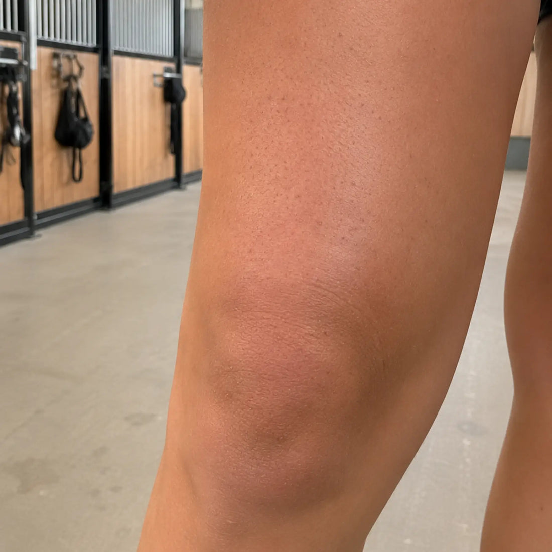 Close-up of an equestrian leg with a visible KP bumps in a stable