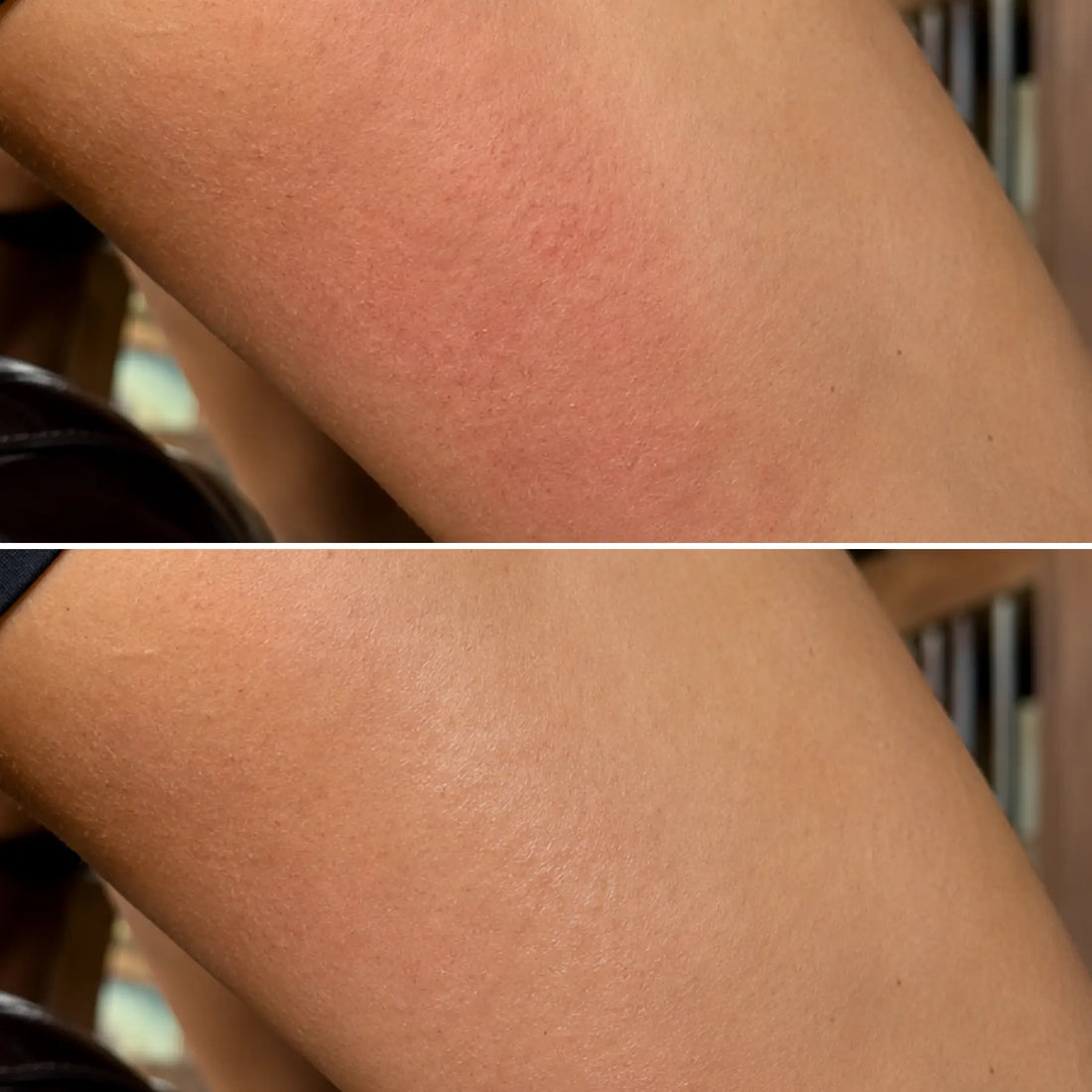 The comparison of an equestrian's sore thigh before and after use CoBa's Daughter Coffee Exfoliator in 6 weeks. Setting in a horse barn.